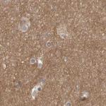 ARHGEF11 Antibody in Immunohistochemistry (IHC)