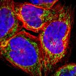 ARMC10 Polyclonal Antibody