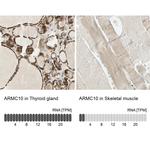 ARMC10 Antibody in Immunohistochemistry (IHC)