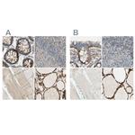 ARMC10 Antibody in Immunohistochemistry (IHC)