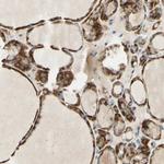 ARMC10 Antibody in Immunohistochemistry (IHC)