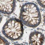 ARMC10 Antibody in Immunohistochemistry (IHC)