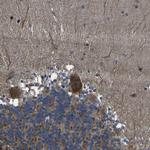 SNN Antibody in Immunohistochemistry (Paraffin) (IHC (P))