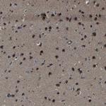 SNN Antibody in Immunohistochemistry (Paraffin) (IHC (P))