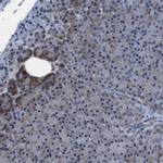 SNN Antibody in Immunohistochemistry (Paraffin) (IHC (P))