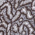 SNN Antibody in Immunohistochemistry (Paraffin) (IHC (P))