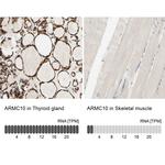 ARMC10 Antibody in Immunohistochemistry (IHC)