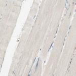 ARMC10 Antibody in Immunohistochemistry (IHC)