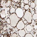 ARMC10 Antibody in Immunohistochemistry (IHC)