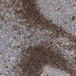 GAPT Polyclonal Antibody