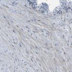 LRRN1 Antibody in Immunohistochemistry (Paraffin) (IHC (P))