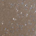 LRRN1 Antibody in Immunohistochemistry (IHC)