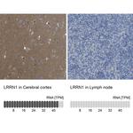LRRN1 Antibody