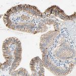 TMIGD2 Antibody in Immunohistochemistry (Paraffin) (IHC (P))