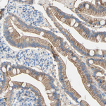 TMIGD2 Antibody in Immunohistochemistry (Paraffin) (IHC (P))