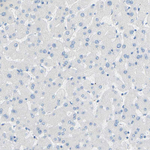 TMIGD2 Antibody in Immunohistochemistry (Paraffin) (IHC (P))