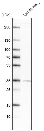 TMIGD2 Antibody in Western Blot (WB)