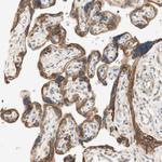 HAI-2 Antibody in Immunohistochemistry (Paraffin) (IHC (P))