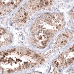 HAI-2 Polyclonal Antibody