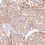 HAI-2 Antibody in Immunohistochemistry (Paraffin) (IHC (P))