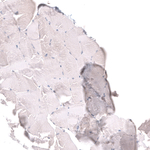 HAI-2 Antibody in Immunohistochemistry (Paraffin) (IHC (P))