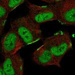 ZNF690 Polyclonal Antibody