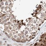ZNF690 Antibody in Immunohistochemistry (IHC)