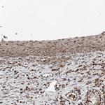 ZNF690 Antibody in Immunohistochemistry (IHC)