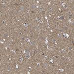 CCDC90B Antibody in Immunohistochemistry (Paraffin) (IHC (P))