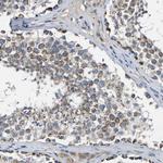 CCDC90B Antibody in Immunohistochemistry (Paraffin) (IHC (P))