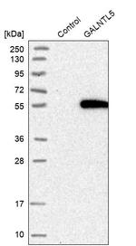 GALNTL5 Antibody in Western Blot (WB)