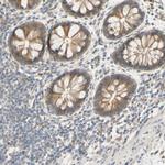 SMIM19 Polyclonal Antibody