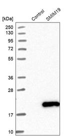 SMIM19 Antibody in Western Blot (WB)