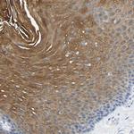 DYNAP Polyclonal Antibody