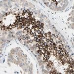 FAM134A Polyclonal Antibody