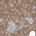SRPRB Antibody in Immunohistochemistry (Paraffin) (IHC (P))