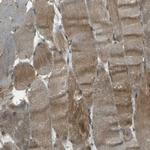 NEXN Polyclonal Antibody