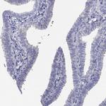CDHR3 Antibody in Immunohistochemistry (IHC)