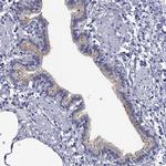 CDHR3 Antibody in Immunohistochemistry (IHC)