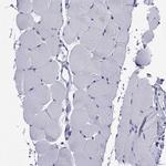 CDHR3 Antibody in Immunohistochemistry (IHC)