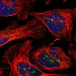 EFCAB14 Polyclonal Antibody