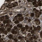 VASN Polyclonal Antibody