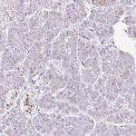 SDF4 Antibody in Immunohistochemistry (IHC)