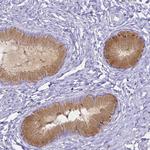 HSPA12A Polyclonal Antibody