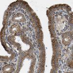 TRAP alpha Antibody in Immunohistochemistry (IHC)