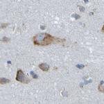 TRAP alpha Antibody in Immunohistochemistry (IHC)