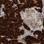 TRAP alpha Antibody in Immunohistochemistry (IHC)