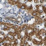 TRAP alpha Antibody in Immunohistochemistry (IHC)