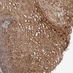 TEX13B Polyclonal Antibody