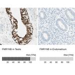 FMR1NB Antibody in Immunohistochemistry (IHC)